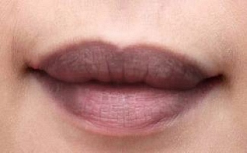 7 Tác hại của son dưỡng môi kém chất lượng 2 tri tham moi